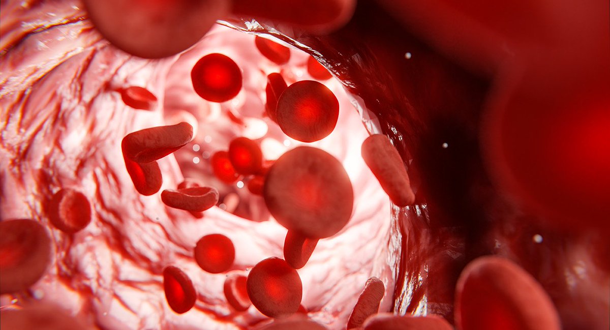 Luspatercept: A Transformative Therapy for Transfusion-Dependent Myelodysplastic Syndromes