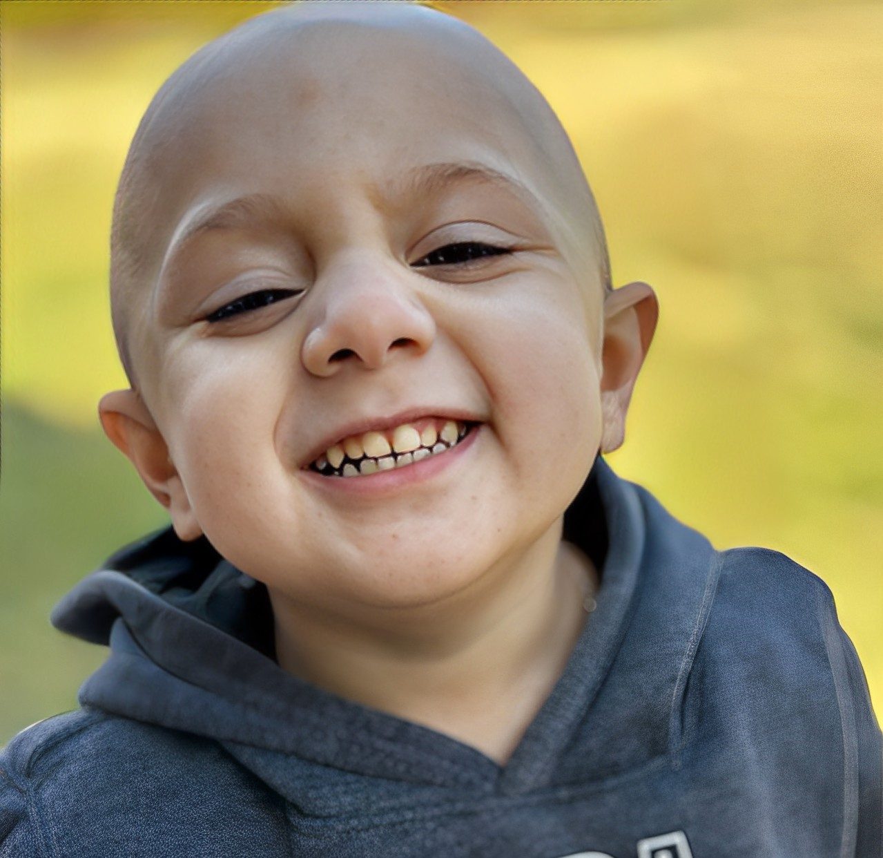 Diagnosed with retinoblastoma at 22 months, Yasin has completed six rounds of chemotherapy, five intravitreal chemotherapy injections and radiation to kill the tumor.- St. Baldrick's Foundation