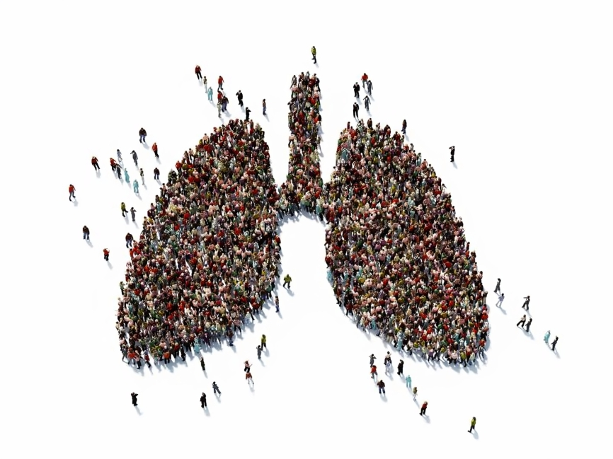 The Pragmatica-Lung Study is considered a model for future cancer clinical trials - National Cancer Institute