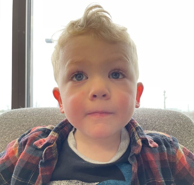 Sam Oches: Today Jude is cancer-free and happily adjusted to life with a prosthetic eye