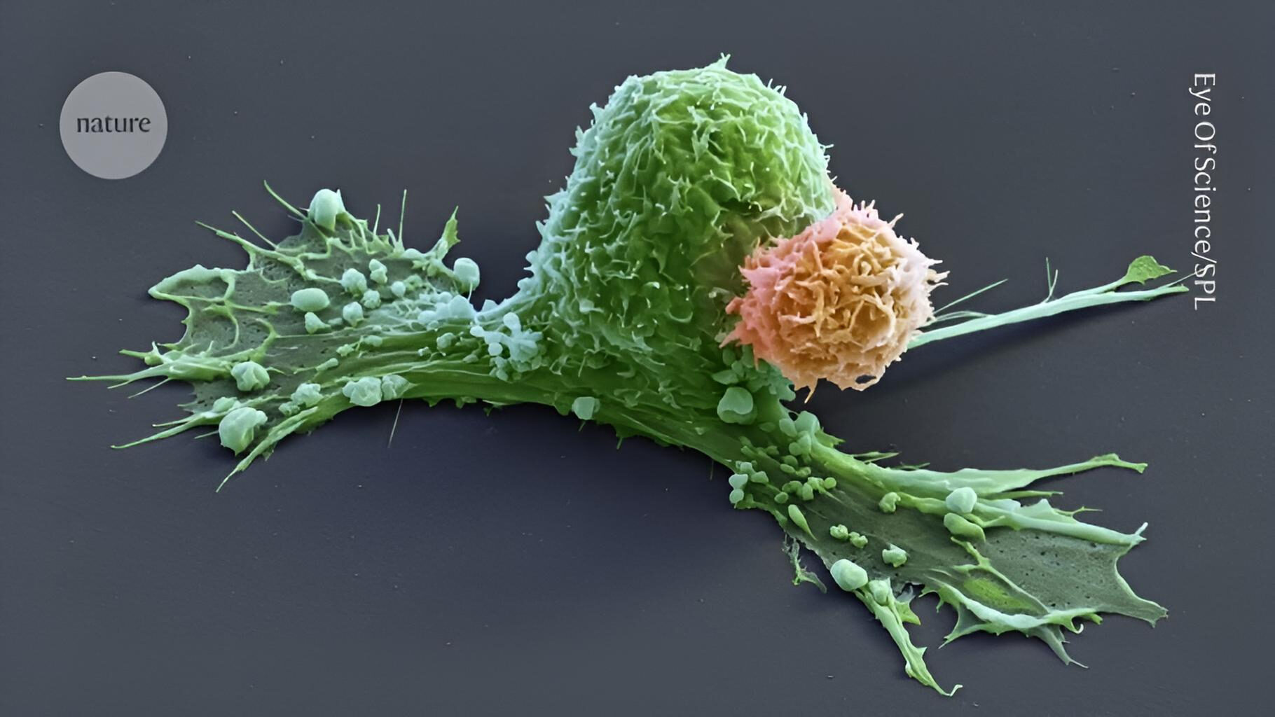 Cancer Research Institute