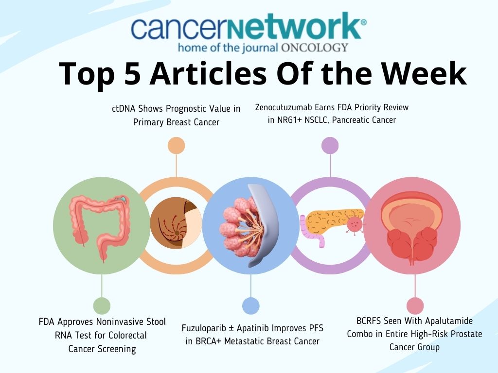 Top 5 articles