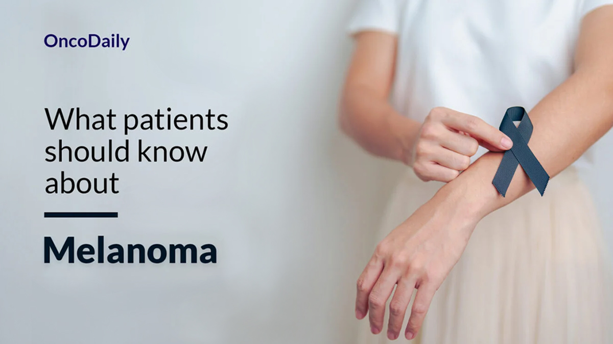 Melanoma