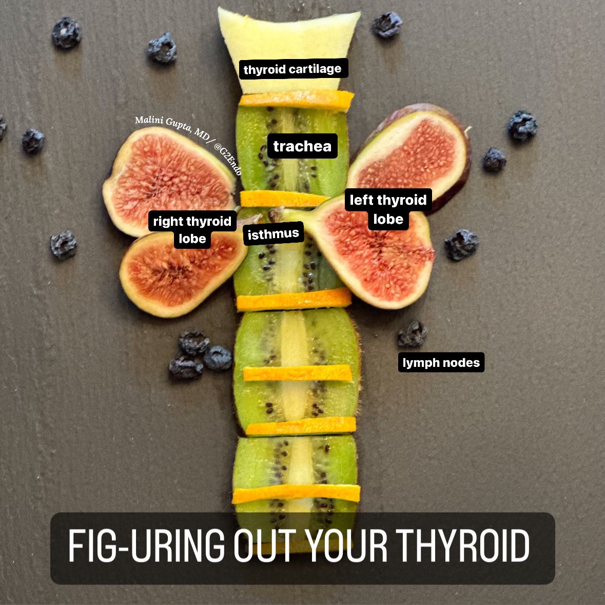 thyroid gland
