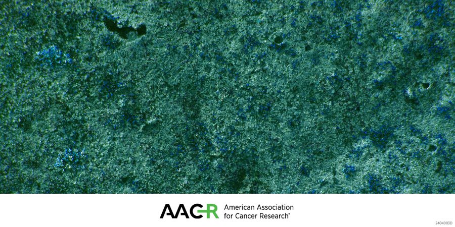 AACR