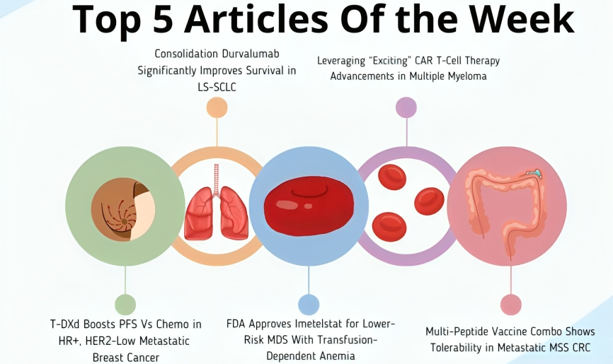 Top 5 articles