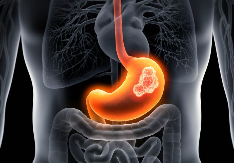 nivolumab