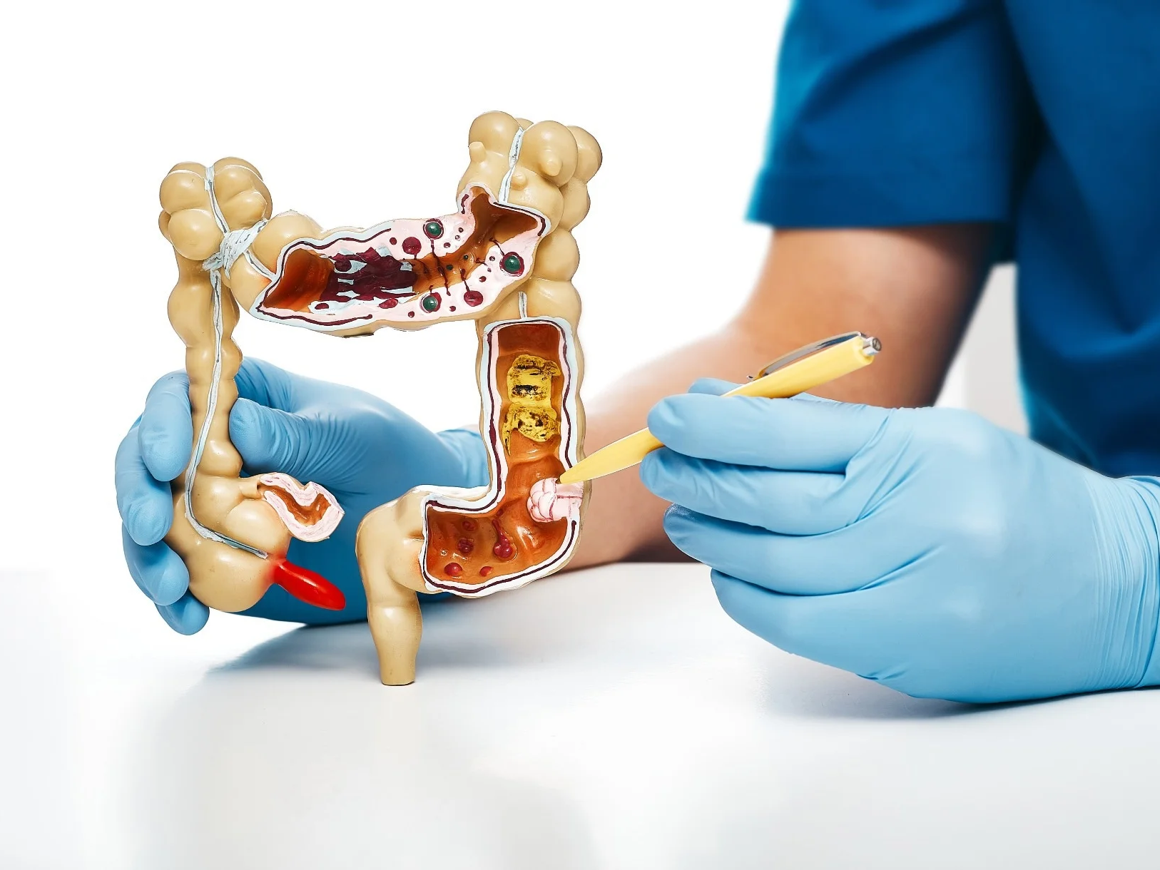 Botensilimab