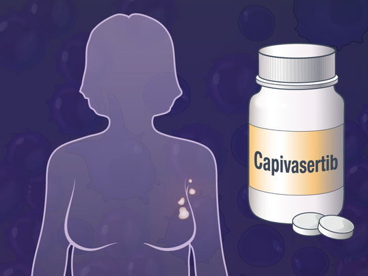 Capivasertib