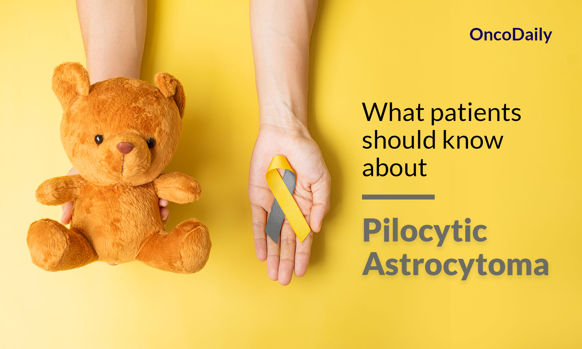 Pilocytic Astrocytoma