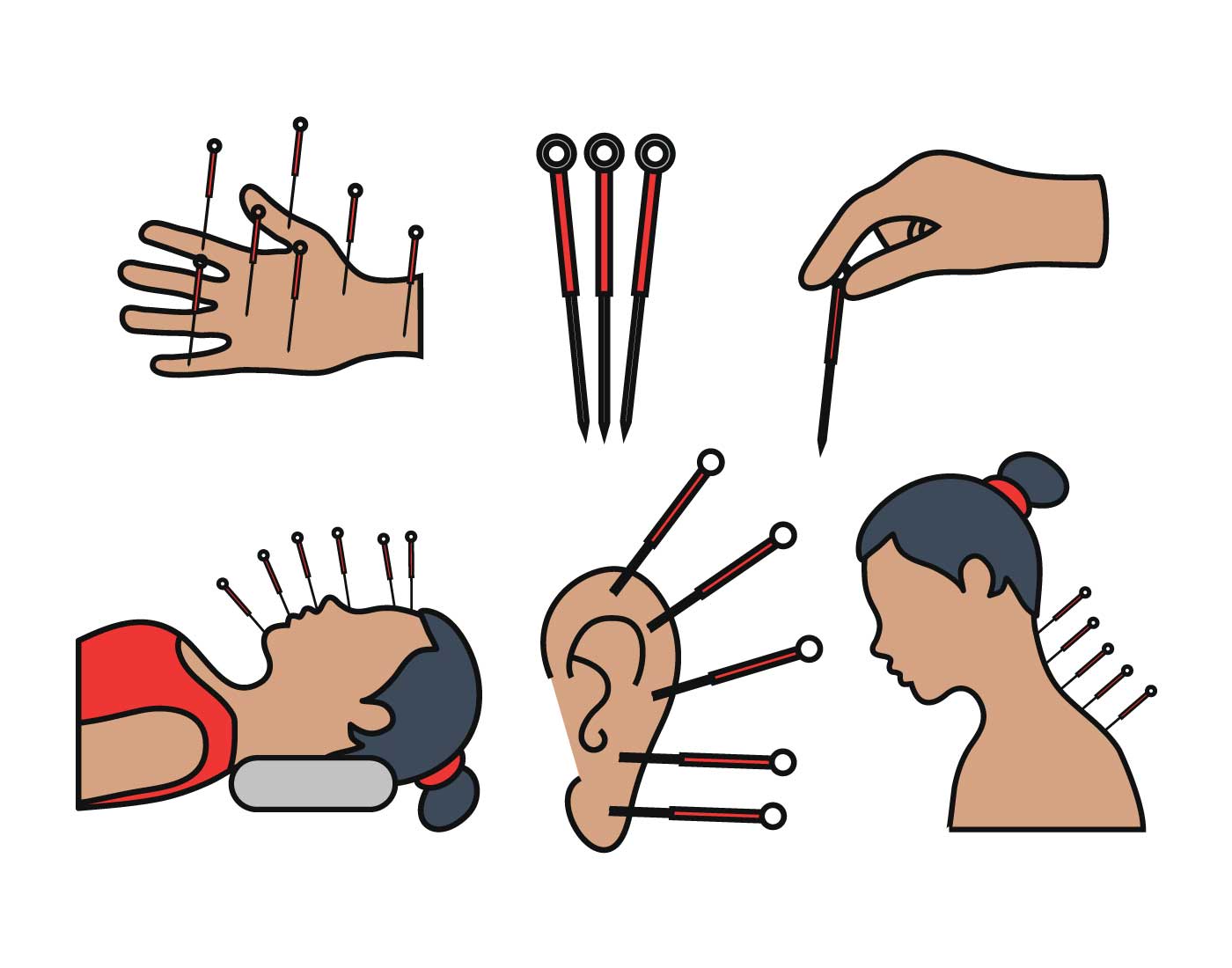 Acupuncture improves