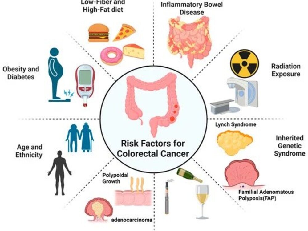 colorectal cancer