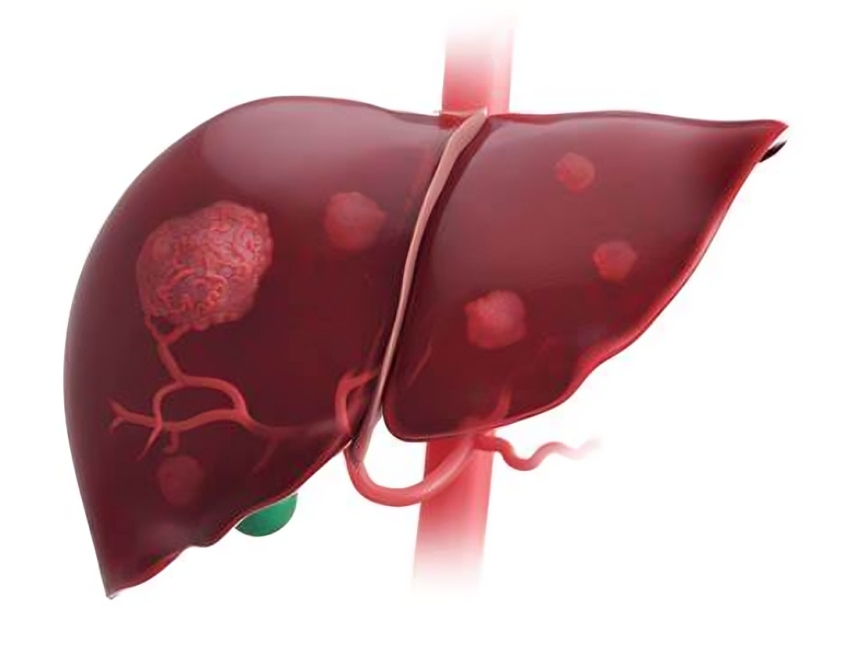 neoadjuvant immunotherapy