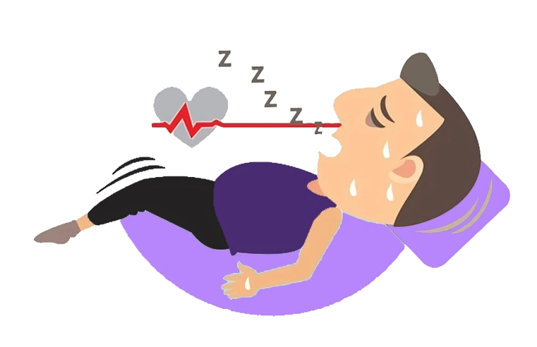 Sleep Apnea