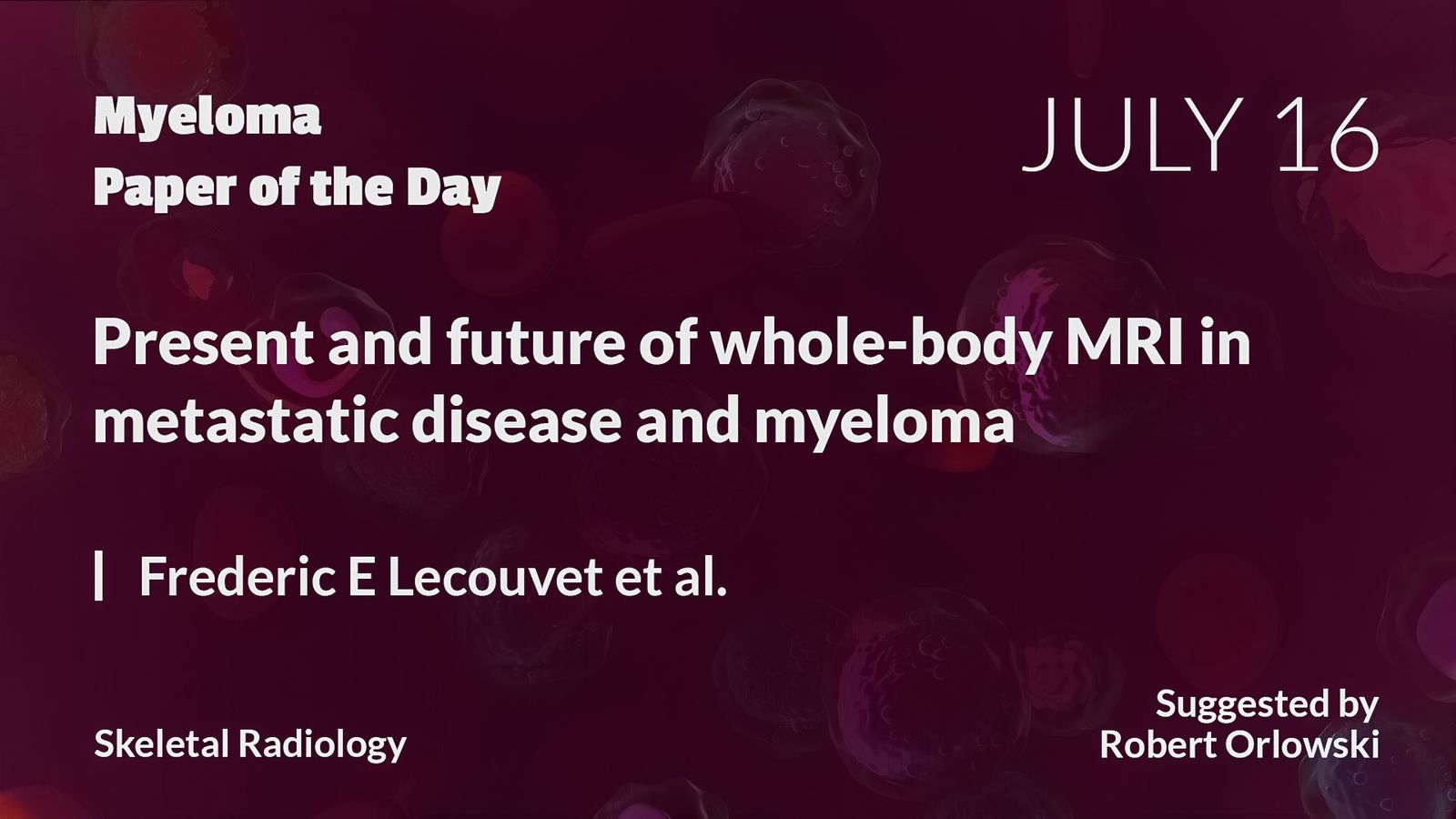 Myeloma Paper Of The Day