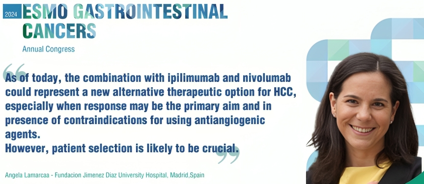 Ipilimumab