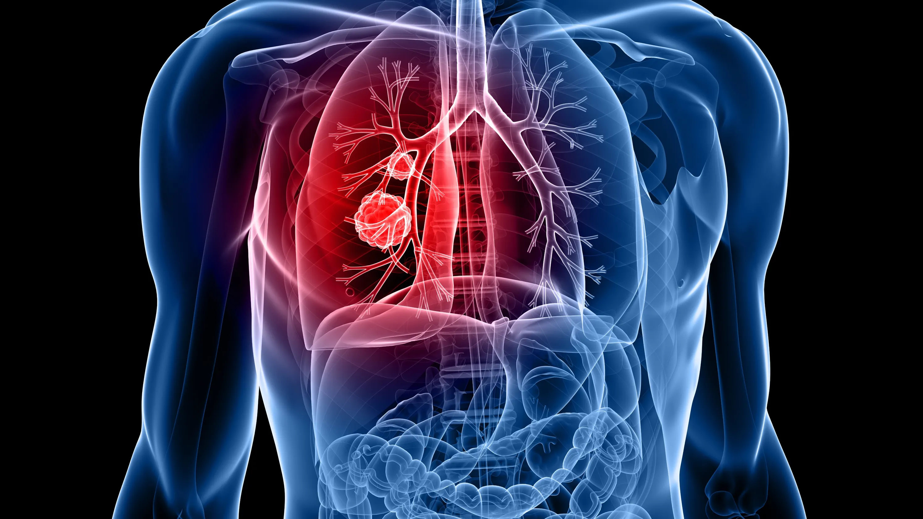 cancer deaths