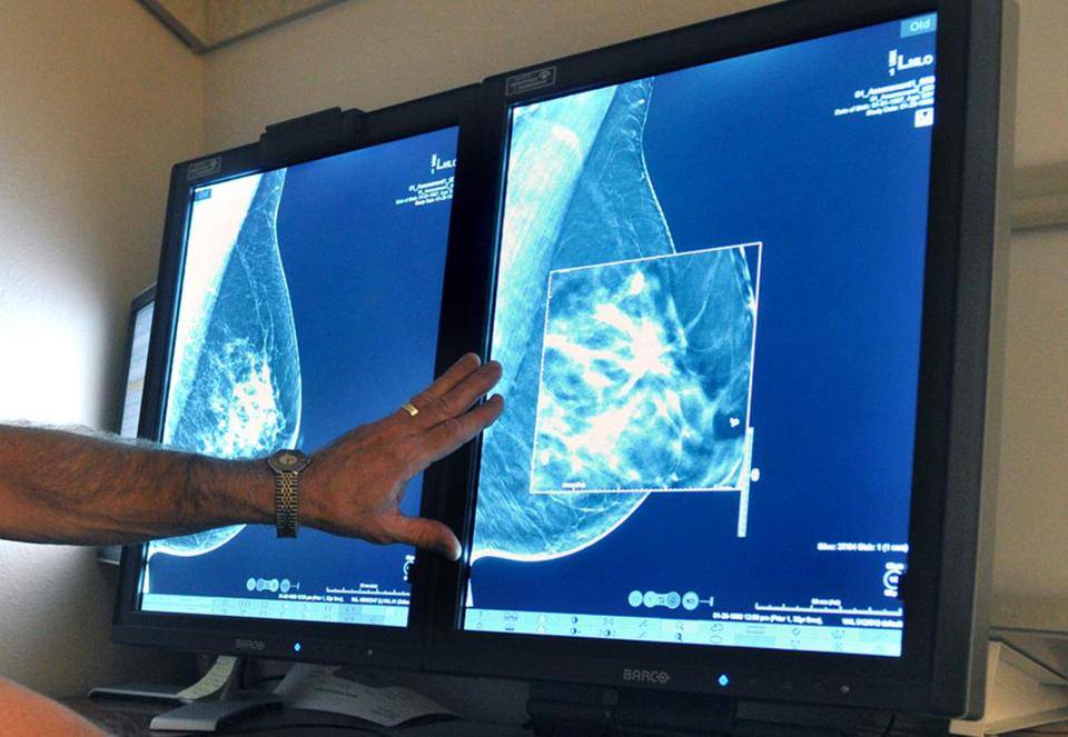 cancer screening