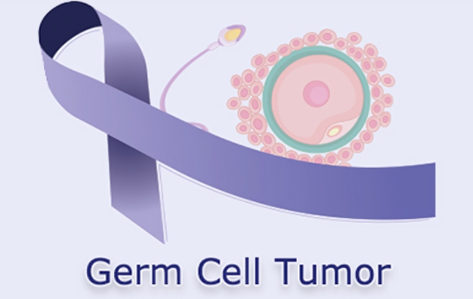 Germ Cell Tumors