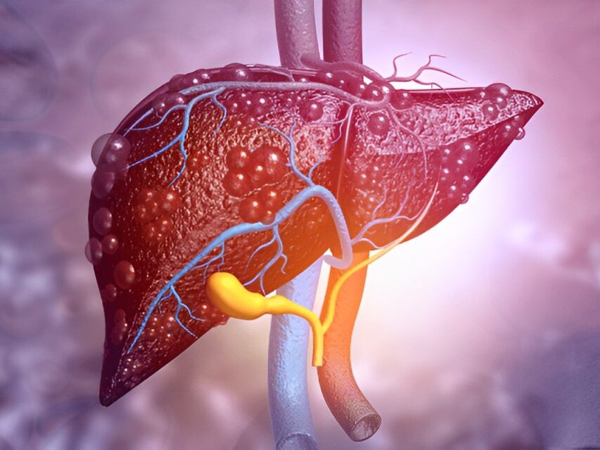 Immunotherapy