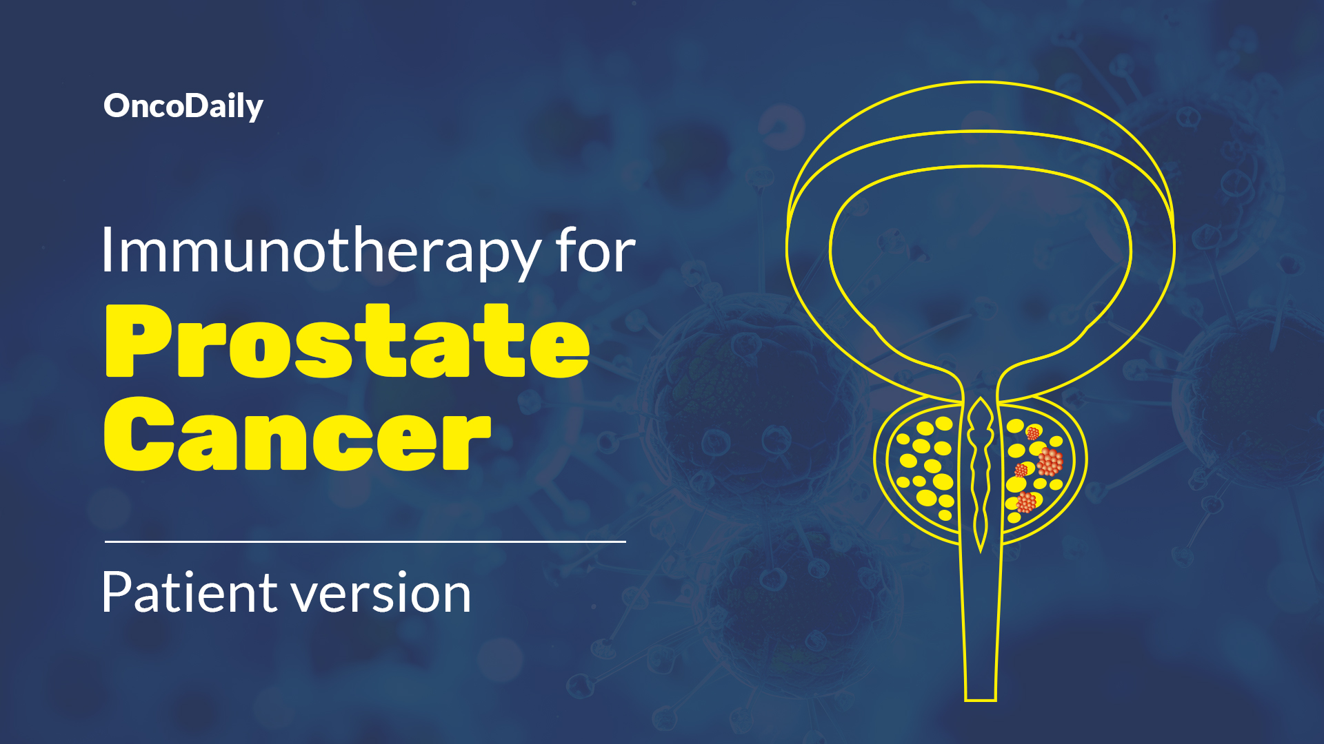 Prostate Cancer