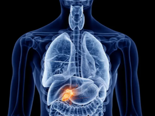 Adjuvant GemCis