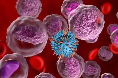 lymphoma