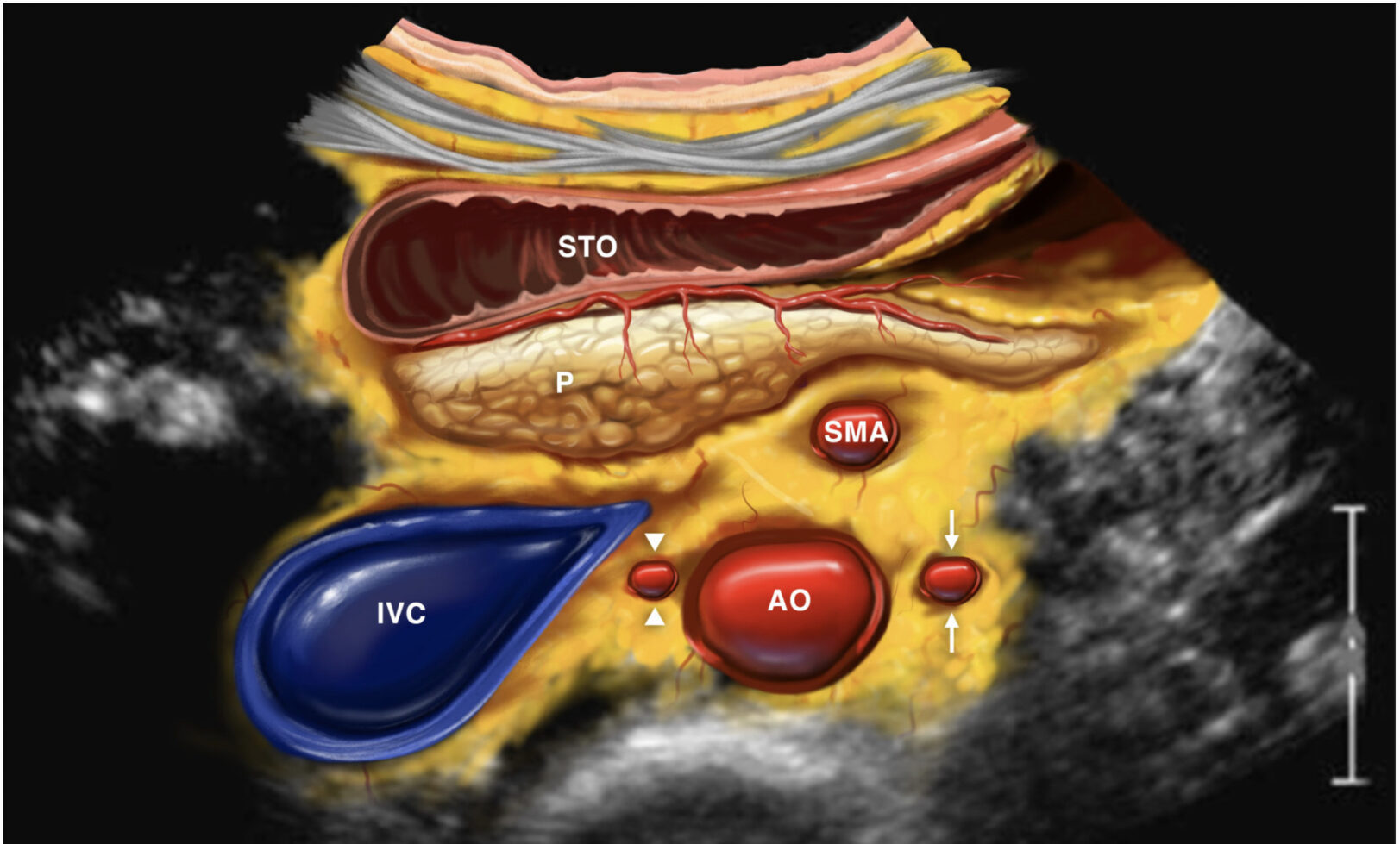 Celiac plexus
