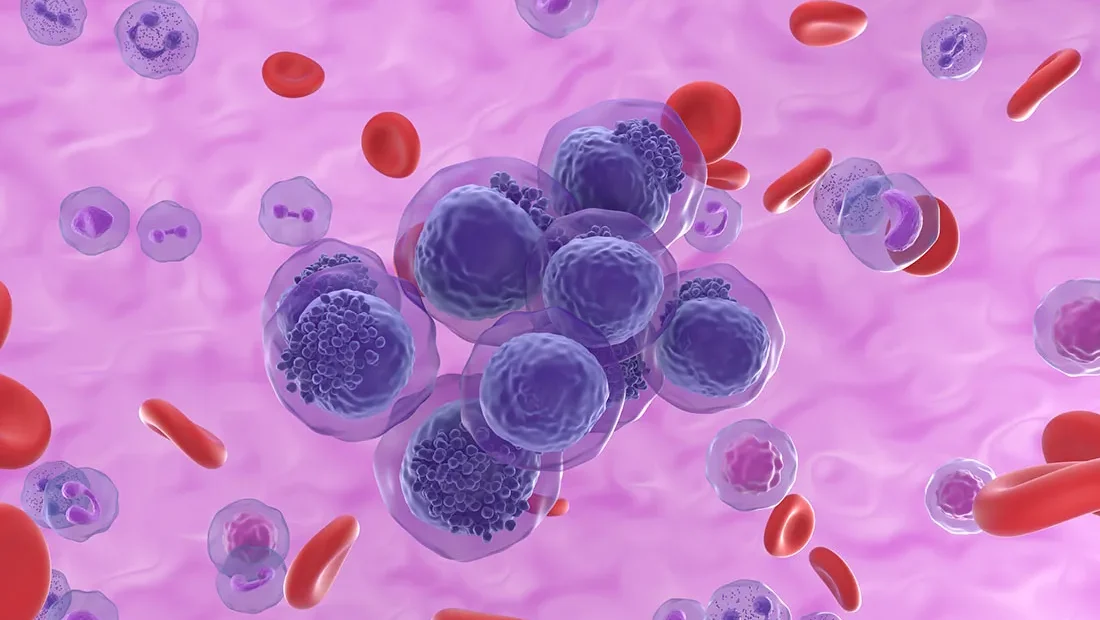 Chemotherapy