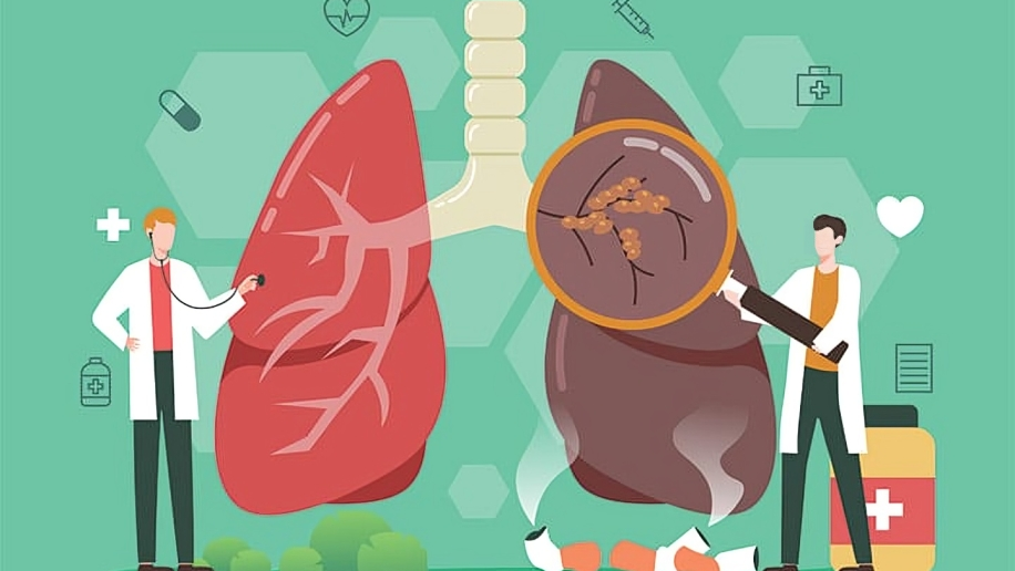 NCCN Guidelines