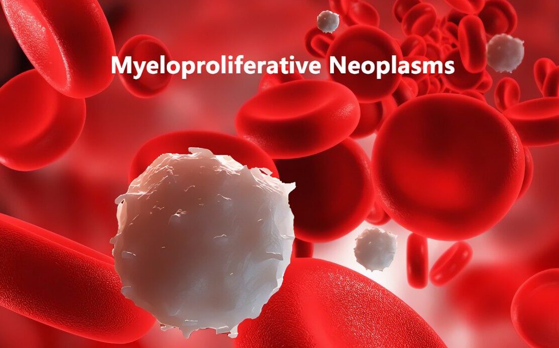 myeloproliferative neoplasms