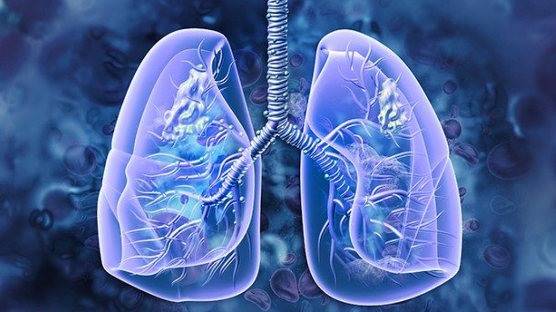 Oncogene Cancer Research