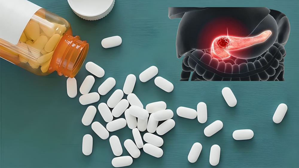 pancreatic cancer