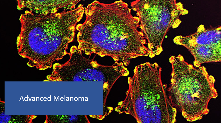 Relatlimab