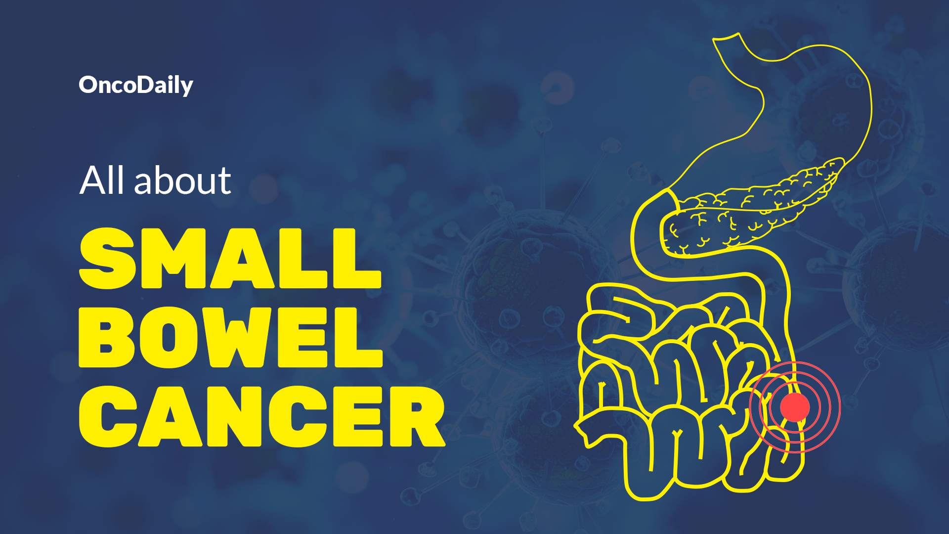 Small Bowel Cancer