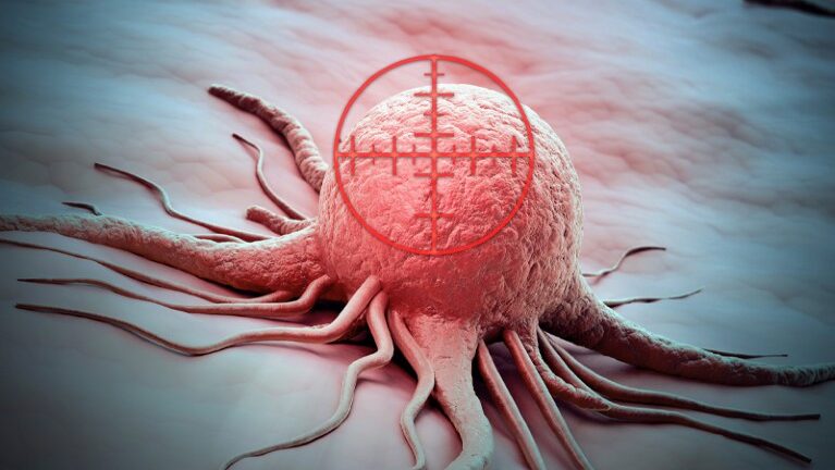 Radioligand Therapy