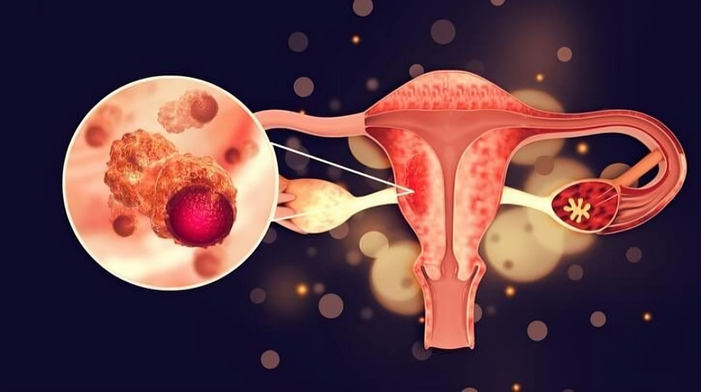 esmo