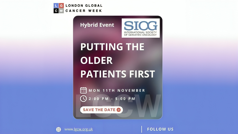SIOG