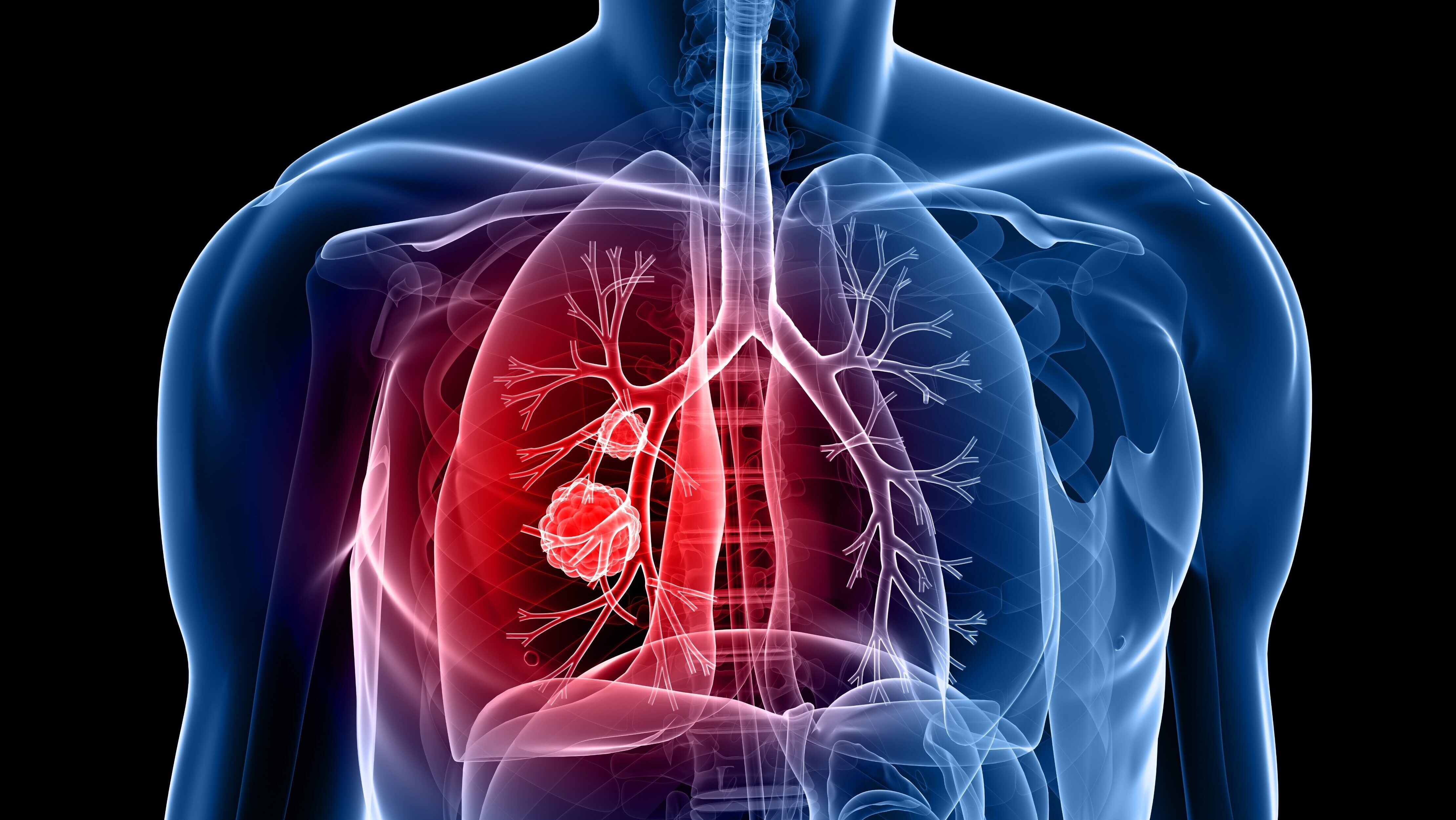 Sacituzumab Govitecan