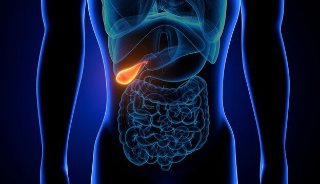 cholecystectomy