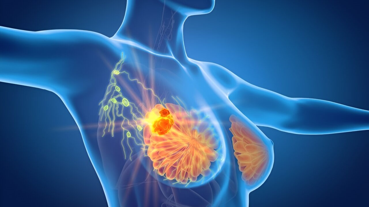 PARP Inhibitor