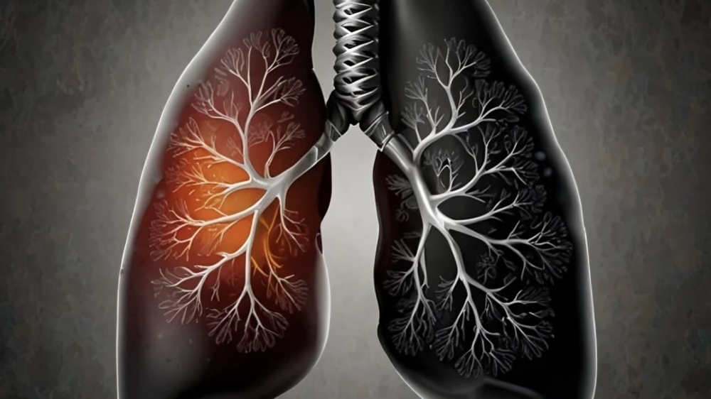 Lung Cancer Awareness Month