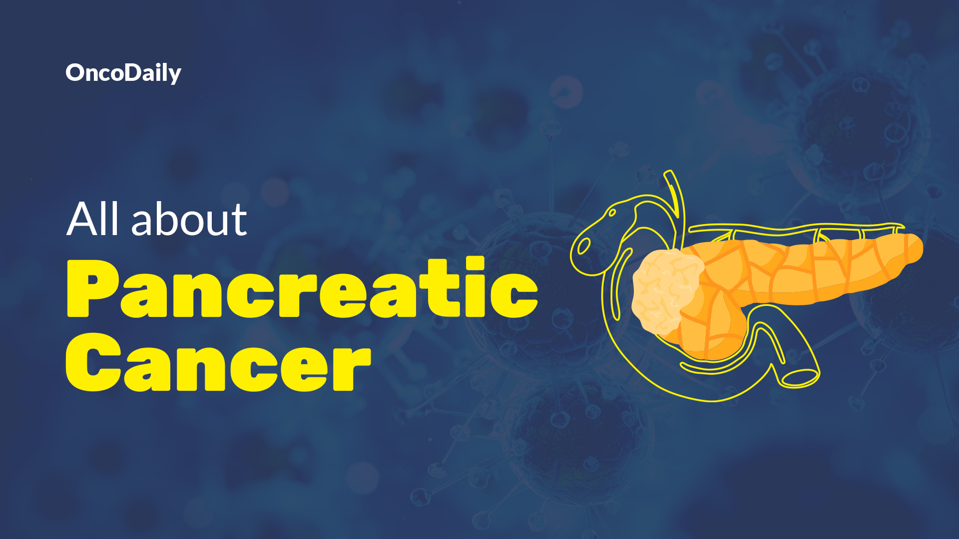 pancreatic cancer