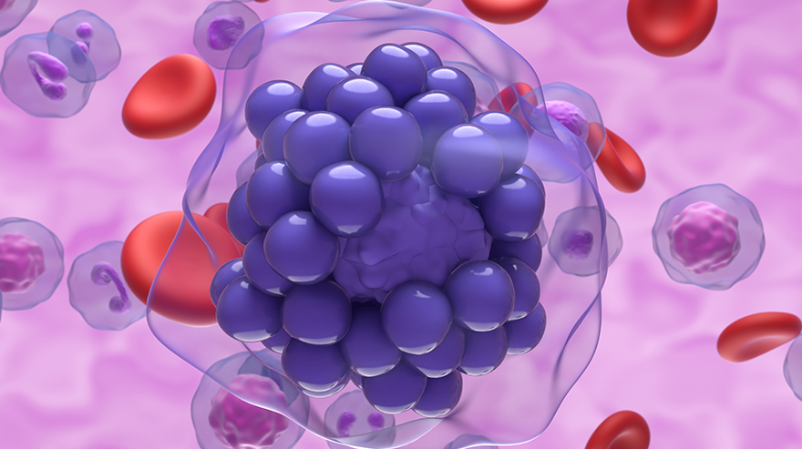 lymphoma