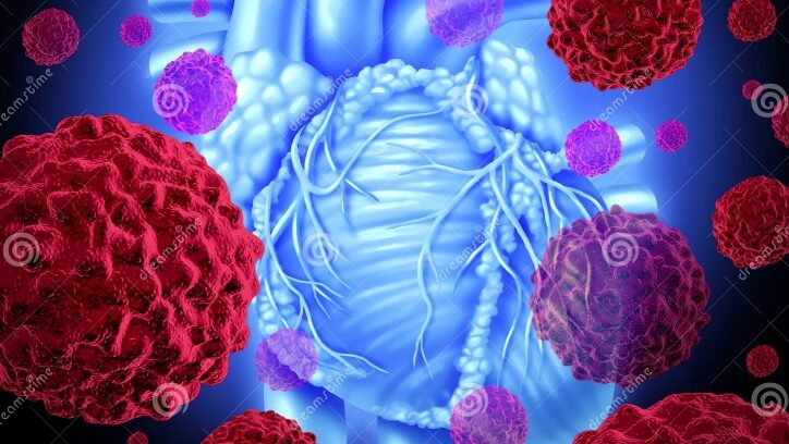 Cardiovascular Disease