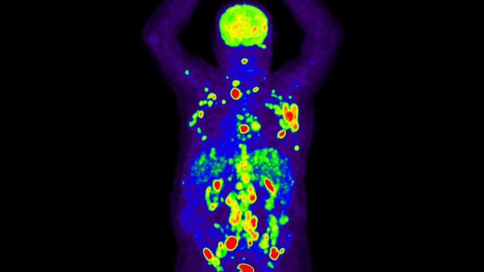 nivolumab