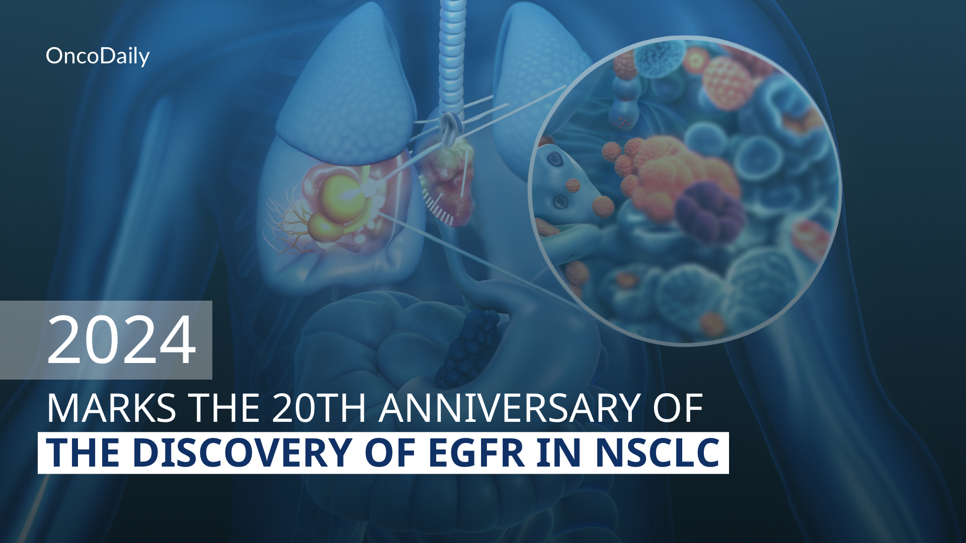 EGFR in NSCLC