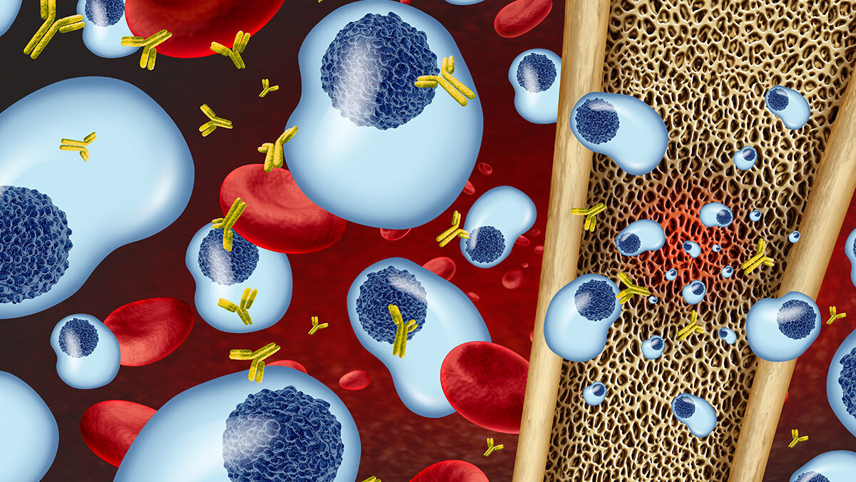 BCMA Multiple Myeloma