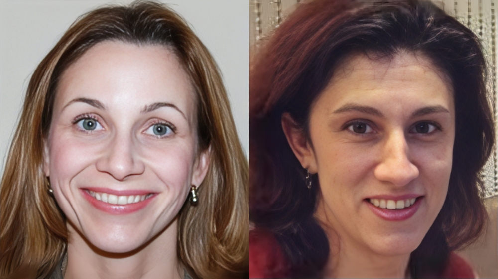 breast cancer brain metastases, Tatiana Prowell