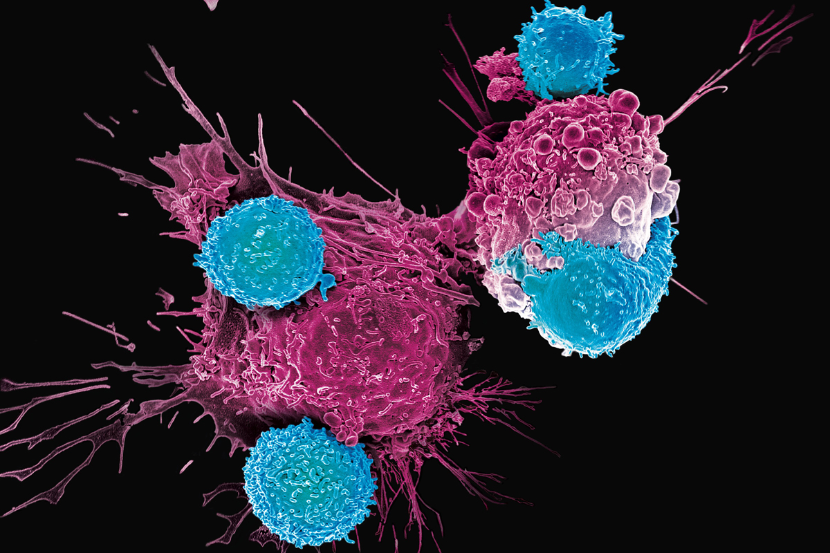 Rational CAR design for augmented T cell function - Journal for ImmunoTherapy of Cancer